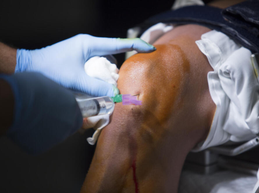 Arthroscopic Surgeries for Sports Injuries