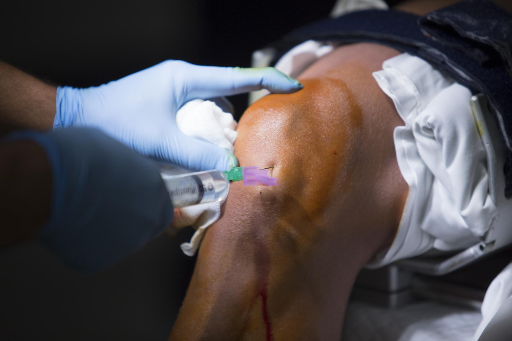 Arthroscopic Surgeries for Sports Injuries