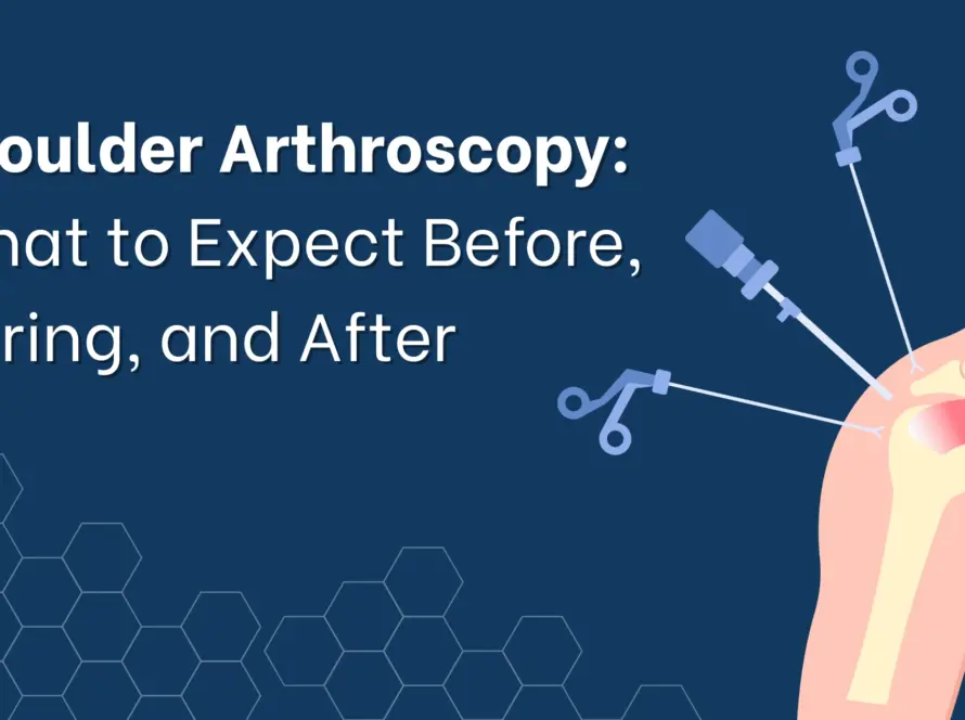 Shoulder Arthroscopy, shoulder pain