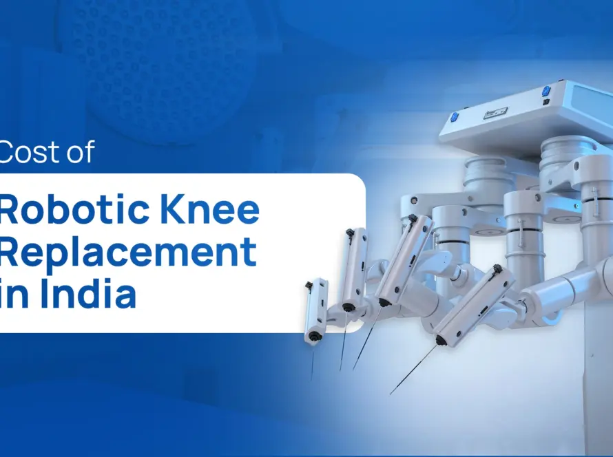 Cost of Robotic Knee Replacement in India