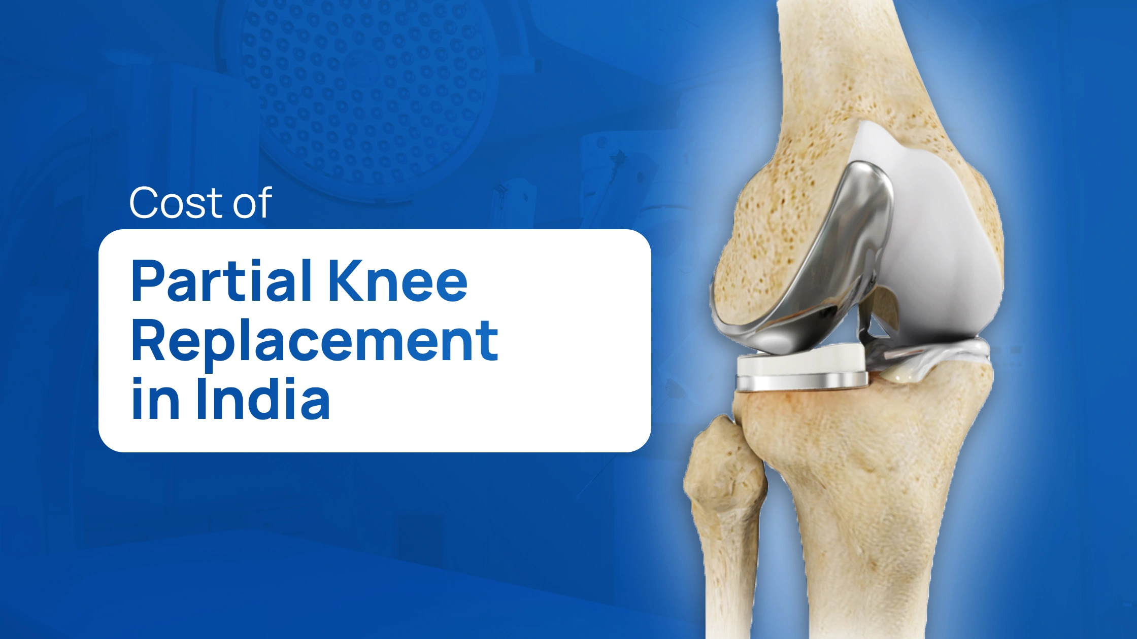Cost of Partial Knee Replacement in India