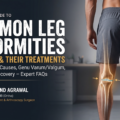 Common Leg Deformities in Adults: Causes, Symptoms, and Expert Treatments by Dr. Mukund Agrawal